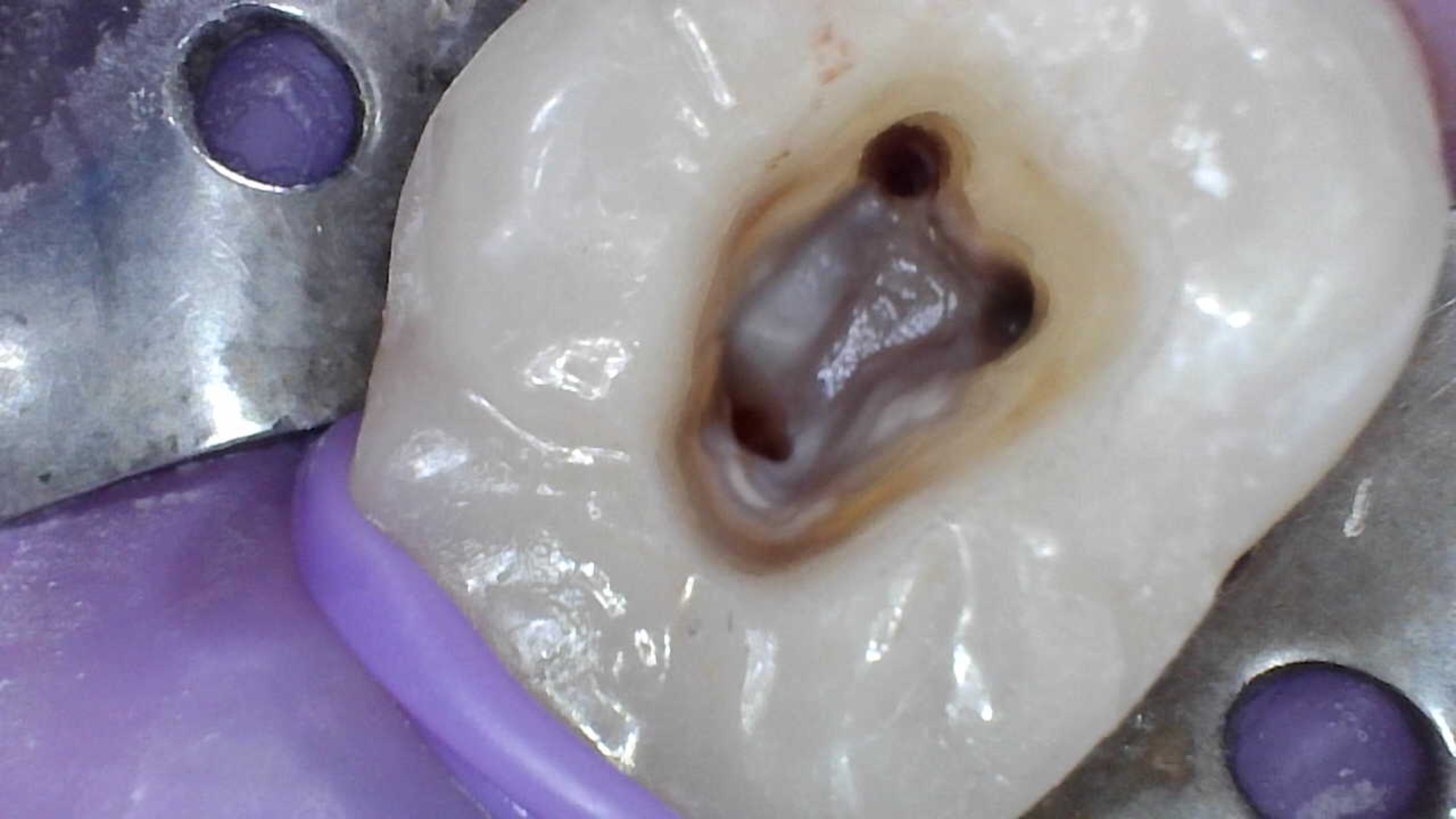 Endodontia